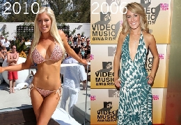 Heidi montag plastic surgery pictures