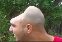 He live with half of head